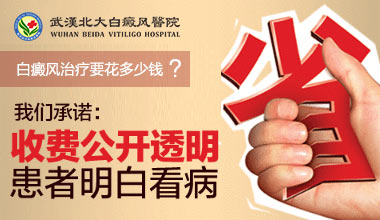 武汉白癜风医院