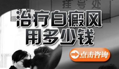 武汉脸部长白癜风专科医院治疗费用高吗