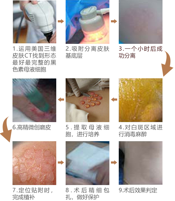 武汉京科白癜风医院