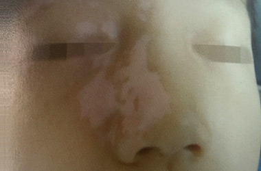 武汉京科白癜风医院