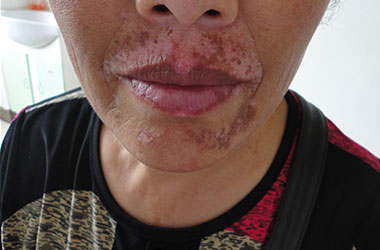 武汉京科白癜风医院