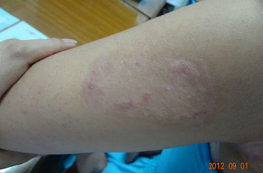 武汉京科白癜风医院