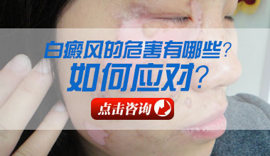 女性白癜风会造成哪些影响?