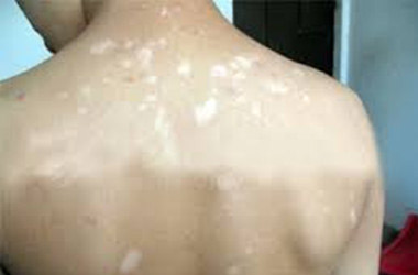 武汉京科白癜风医院