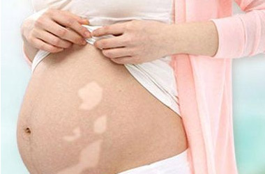 孕妇患者剖腹产了后期白斑会扩散吗?