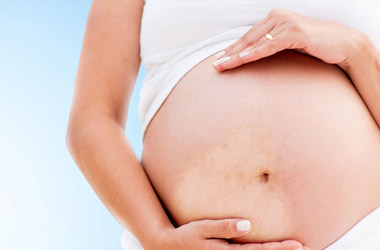 孕妇患者剖腹产了后期白斑会扩散吗?