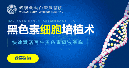 襄阳白癜风患者治疗方法有哪些是什么呢?