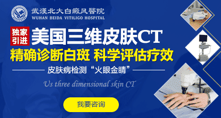 为什么白癜风会扩散?