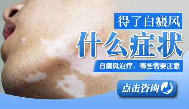 白癜风好转的症状是什么?