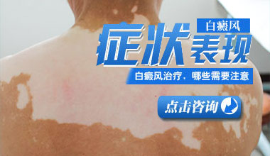 咸宁白癜风医院医生教你怎样正确识别白癜风早期症状?